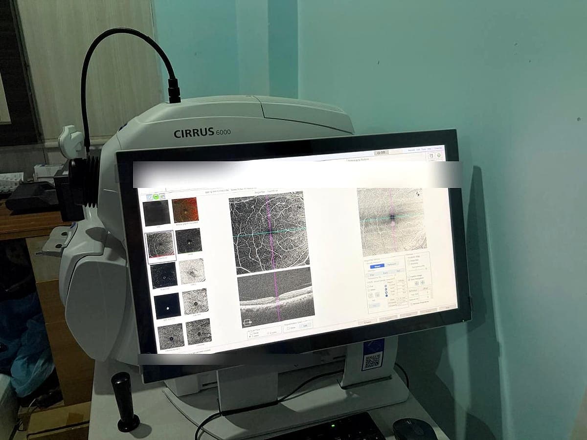 Zeiss Cirrus 6000 OCT angiography machine showing retinal blood vessels