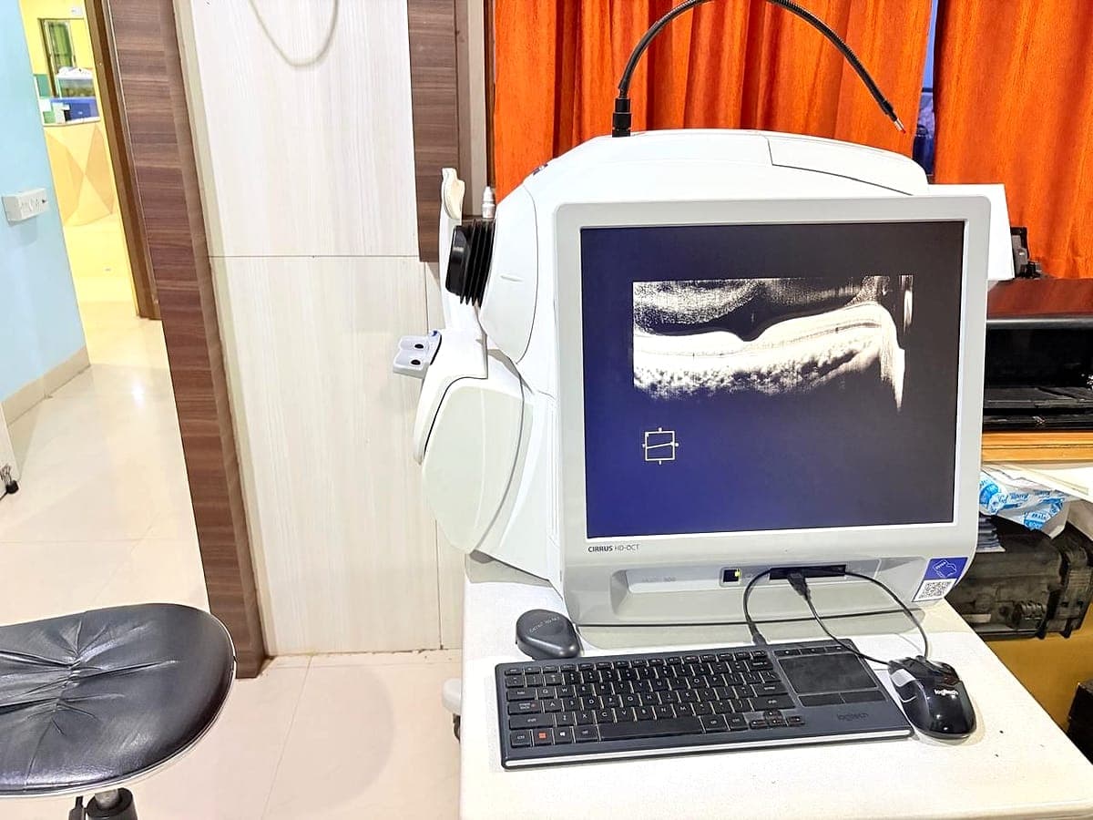 Zeiss Cirrus HD-OCT 500 scanner showing a retina scan at Ruby Eye Hospital